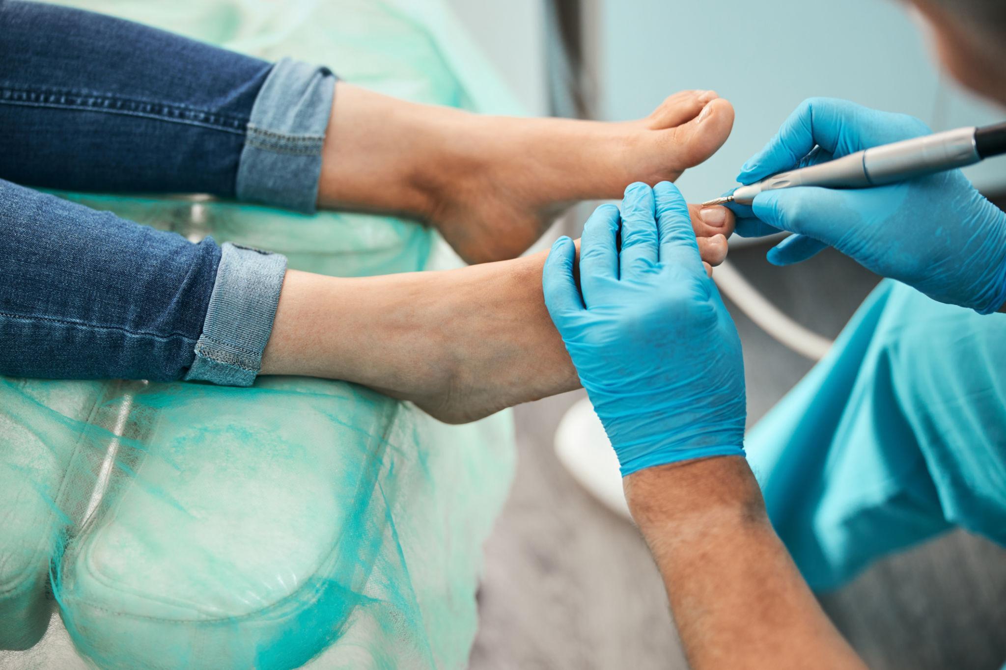 PEDICURA CLÍNICA